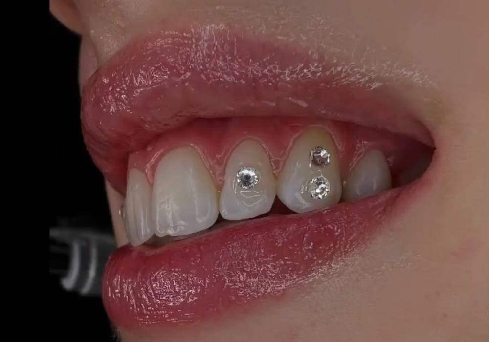 3 Swarovski Tooth Gem