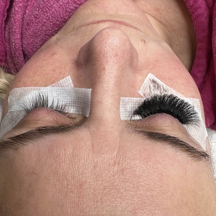 Lash Removal