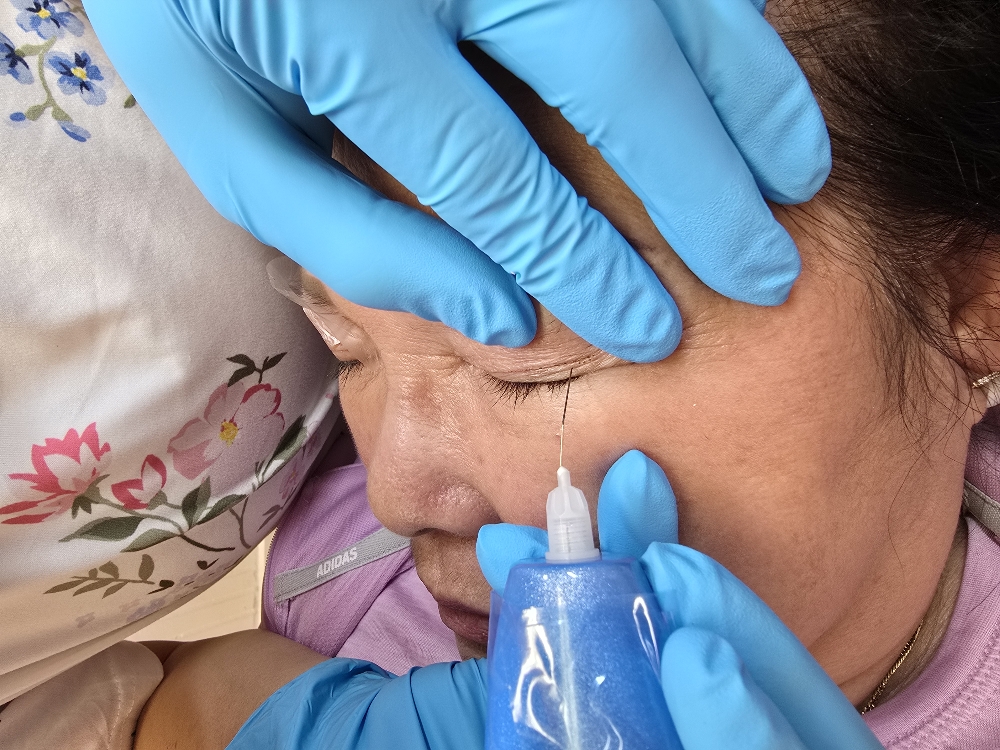 Plasma Eyebrows Remover