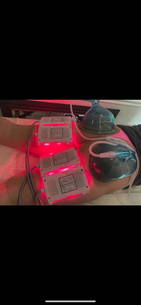 Lipo, BBL, Lymphatic Roller