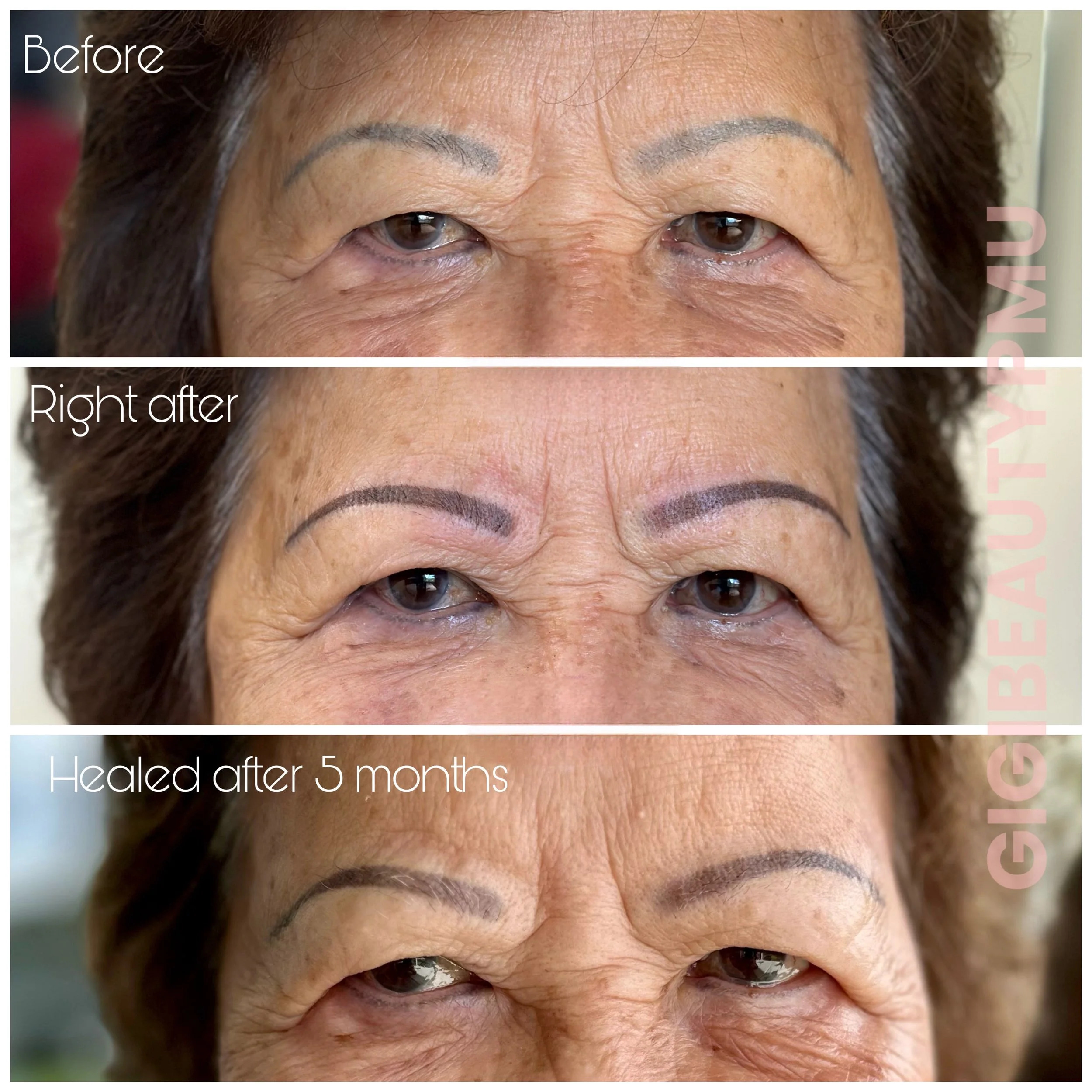 Eyebrow Correction