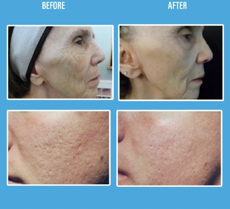 Basic Procell Therapies Facial at Enhanced Beauty Esthetics in Pass Christian, MS