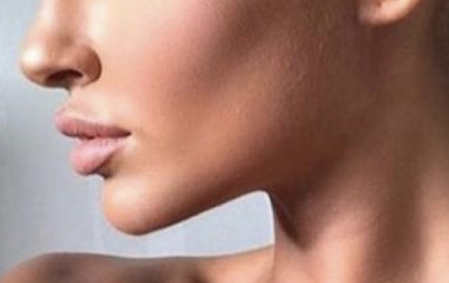 RF Skin Tightening Facial