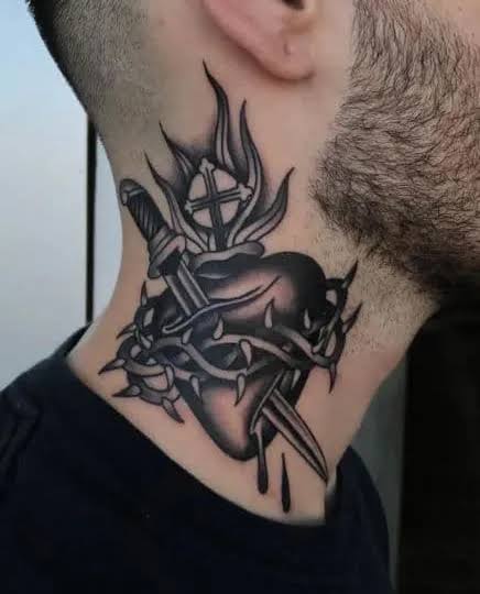 M LASER TATTOO REMOVAL