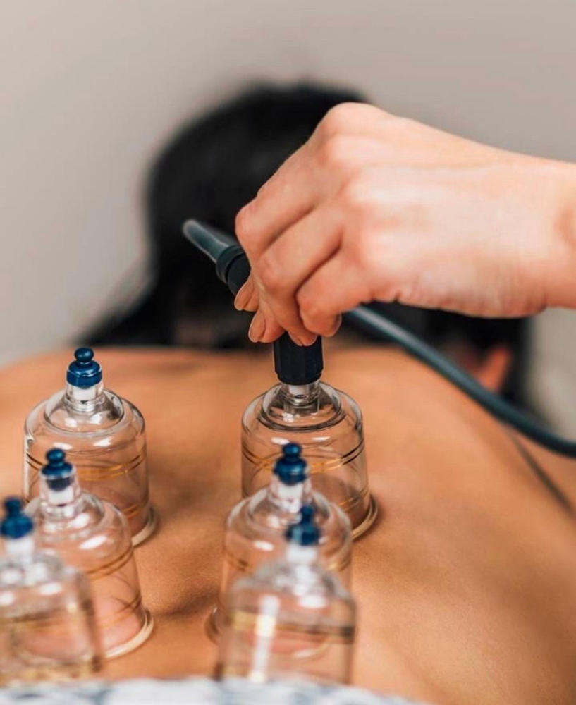 Cupping at Maine MassageLuxe in Sabattus, ME