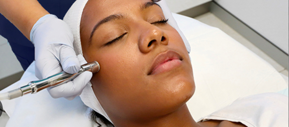 Micro dermabrasion facial
