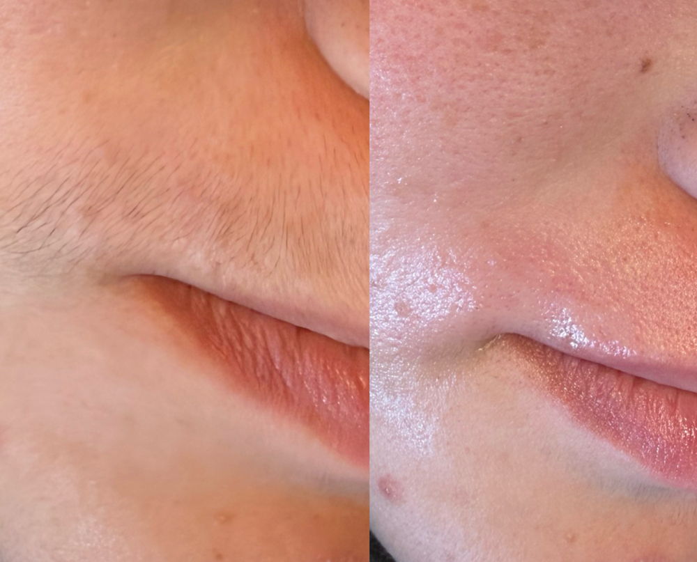 Upper Lip Wax at Skin By Jazz LLC in Wisconsin Rapids, WI