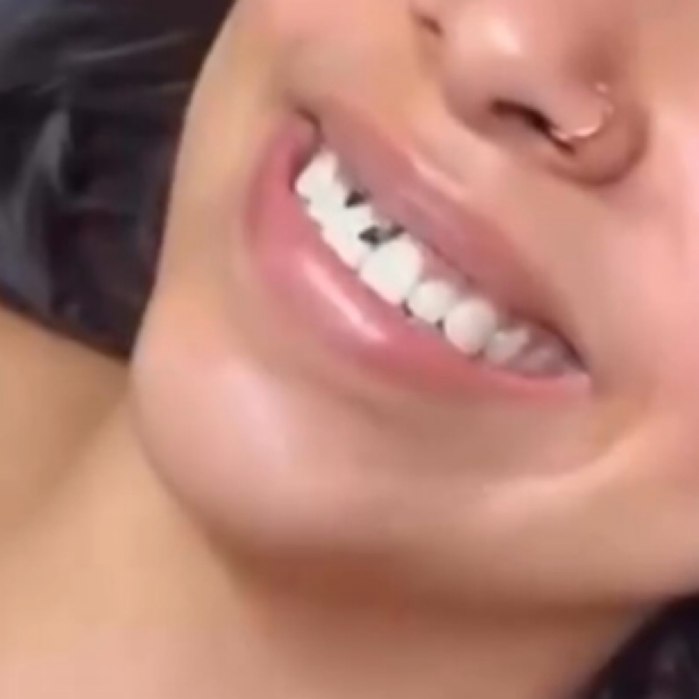 Teeth Whitening at Aurelia Headspa in Reading, PA