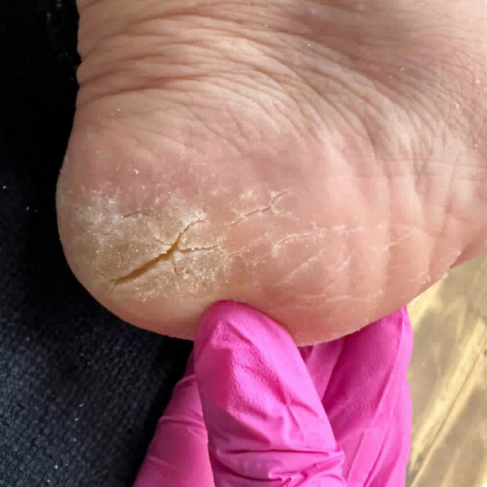 ADD ON EXTENSIVE CALLUS TREATMENT at Mariposa Salon LLC in San Diego, CA