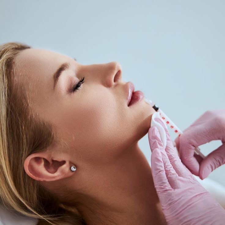 Dermal Filler
