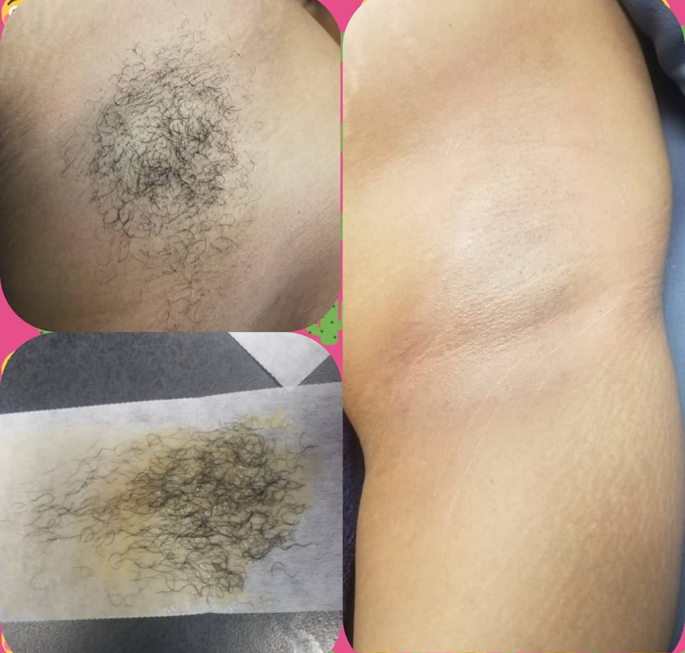 Underarm wax