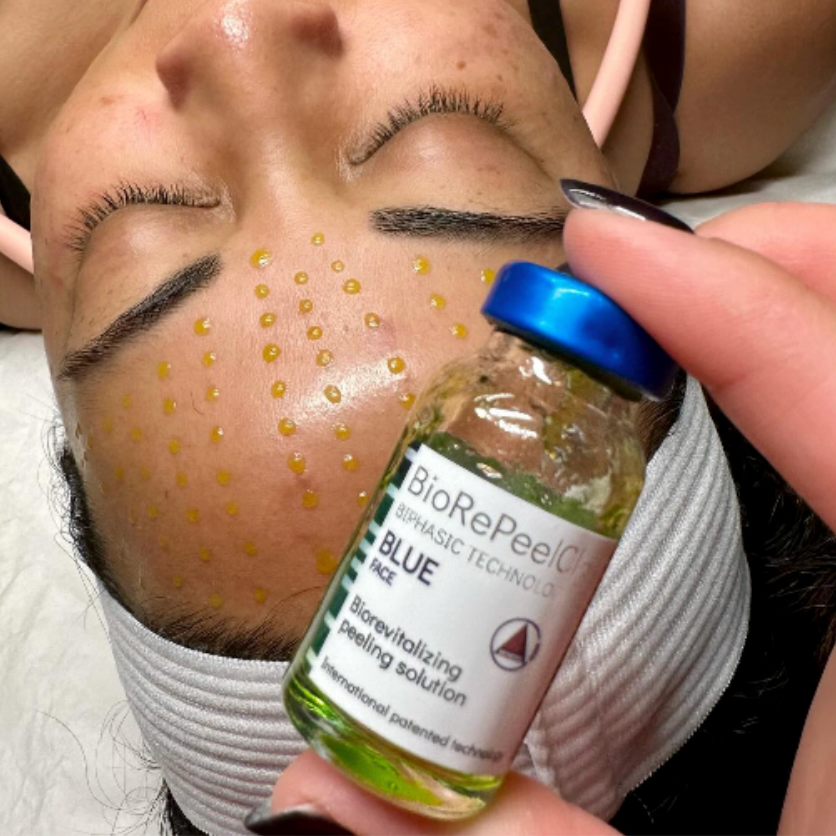 BioRePeelCl3 BioSkin at Quiet Beauty Spa in Newport Beach, CA