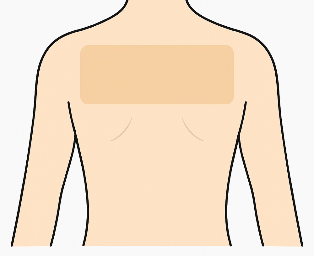 Upper Back at BareSkinAesthetics in Ridgeland, MS