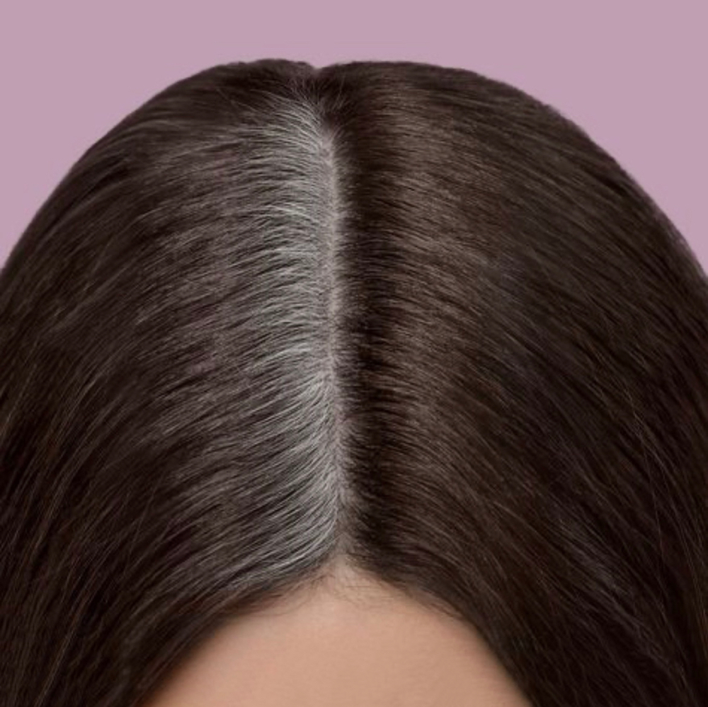 Roots/ Gray Coverage