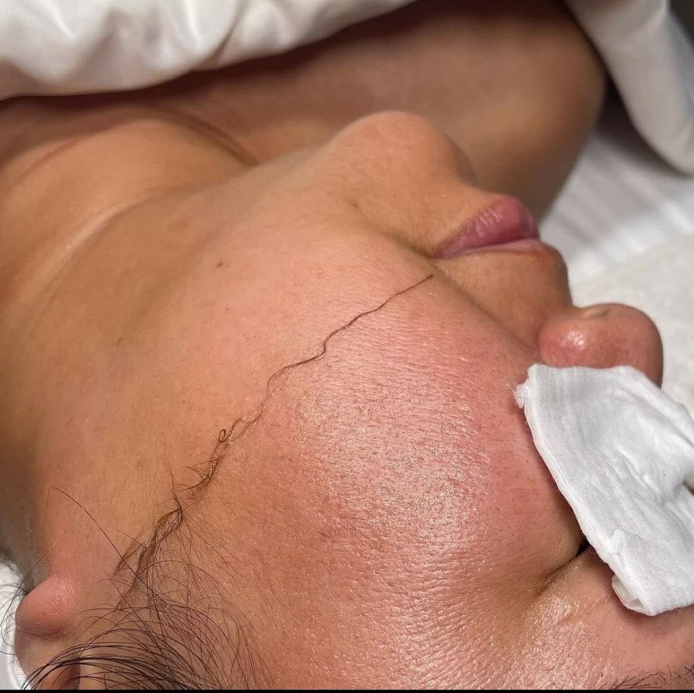 Dermaplaning at Rachel Facial in Jacksonville, FL