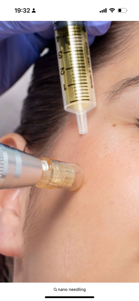 Collagen Therapy- Nanoneedling