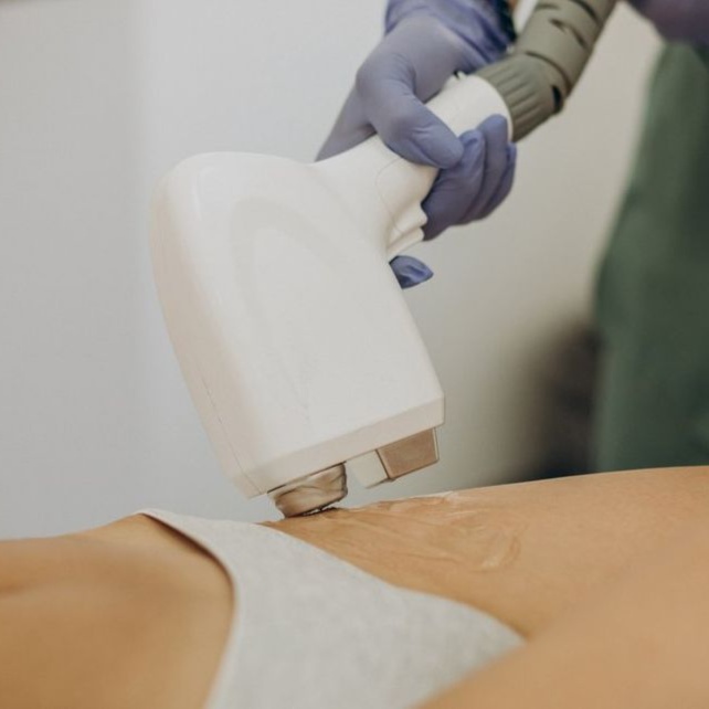 LASER | BRAZILIAN at EROXSPA in Houston, TX