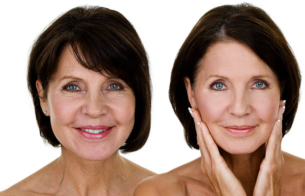 DermaplanePro Ageless Facial