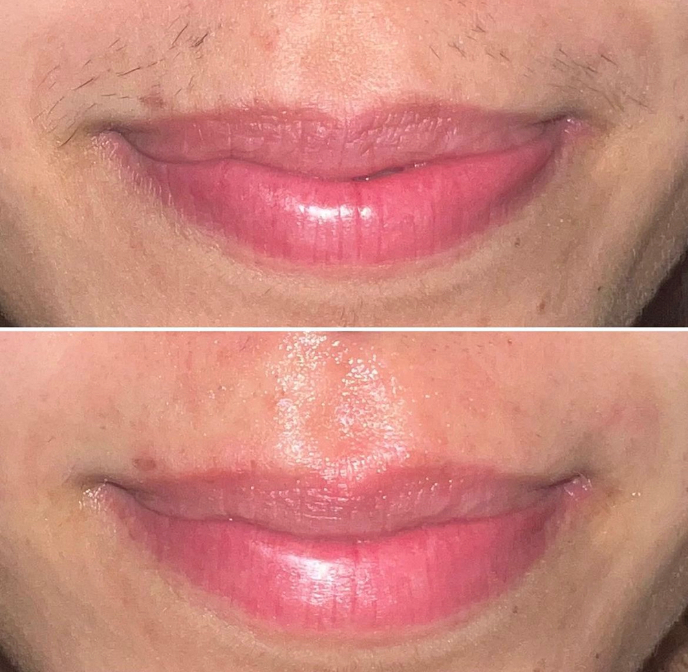 Upper Lip Wax