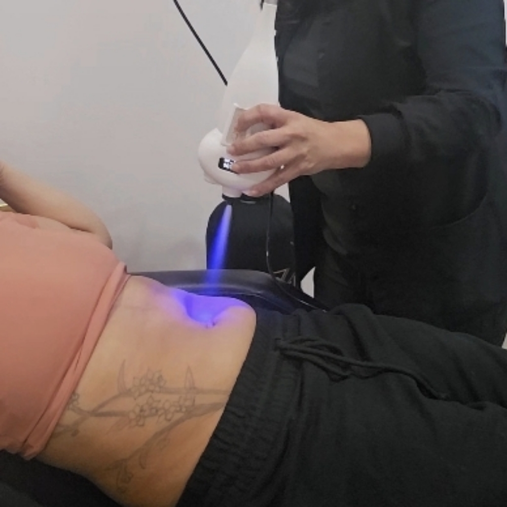 Cryo Sculpting MED AREA at SkinDeep in El PASO, TX