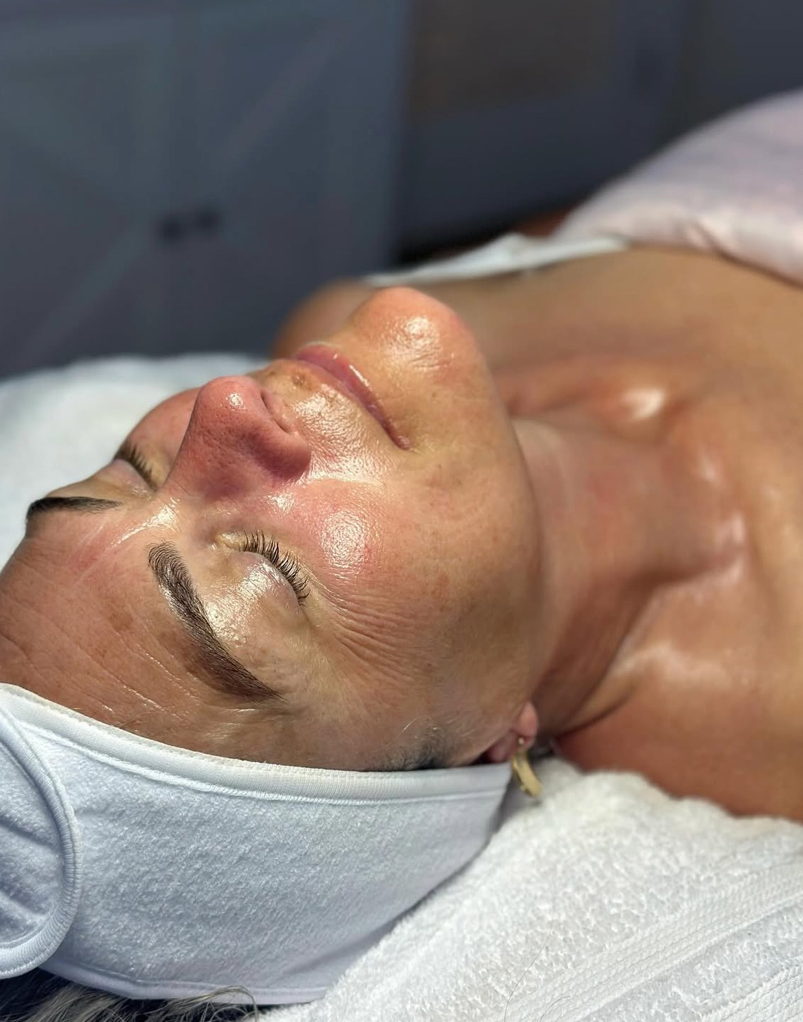 Microdermabrasion Facial