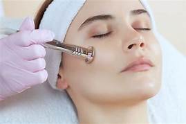 Microdermabrasion Facial