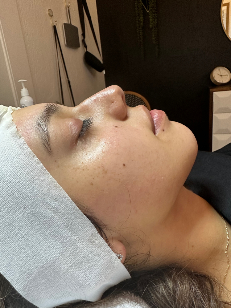 Custom Facial