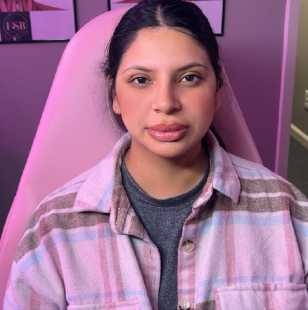 Lip + Botox Glow Package at Flawless Spa & Beauty in Fort Worth, TX