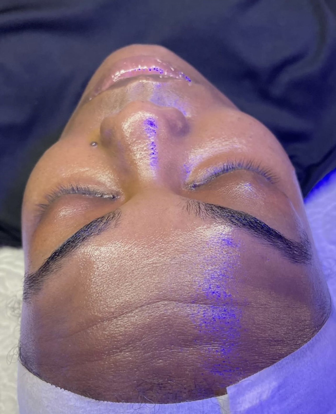 Vitamin C Glow Facial