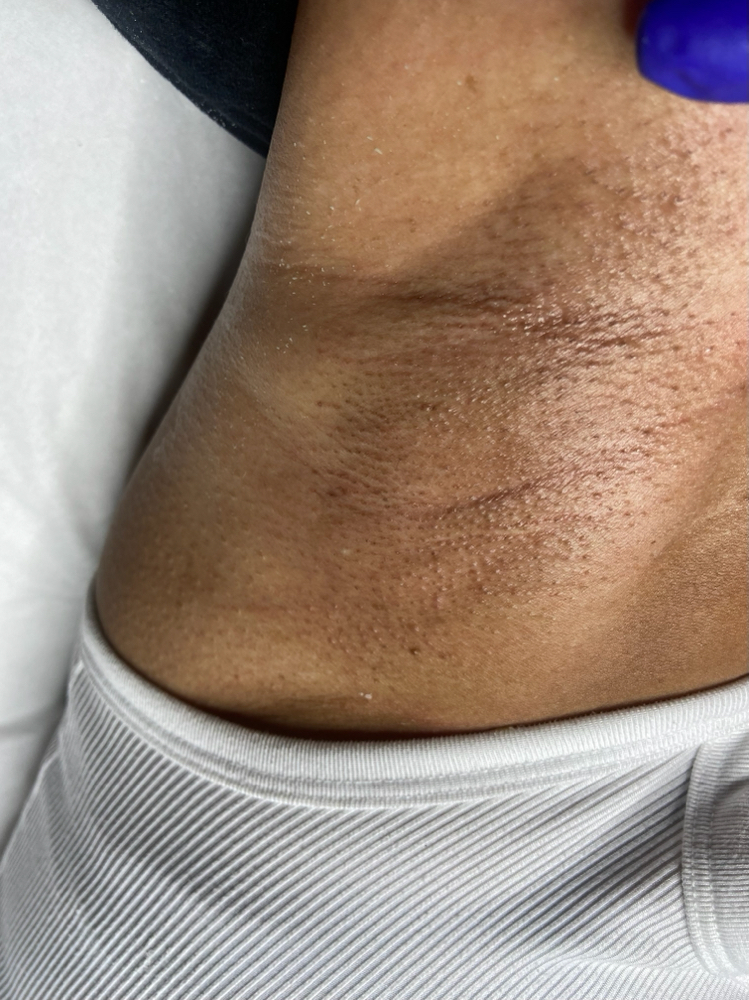 Underarm Wax ( Female )