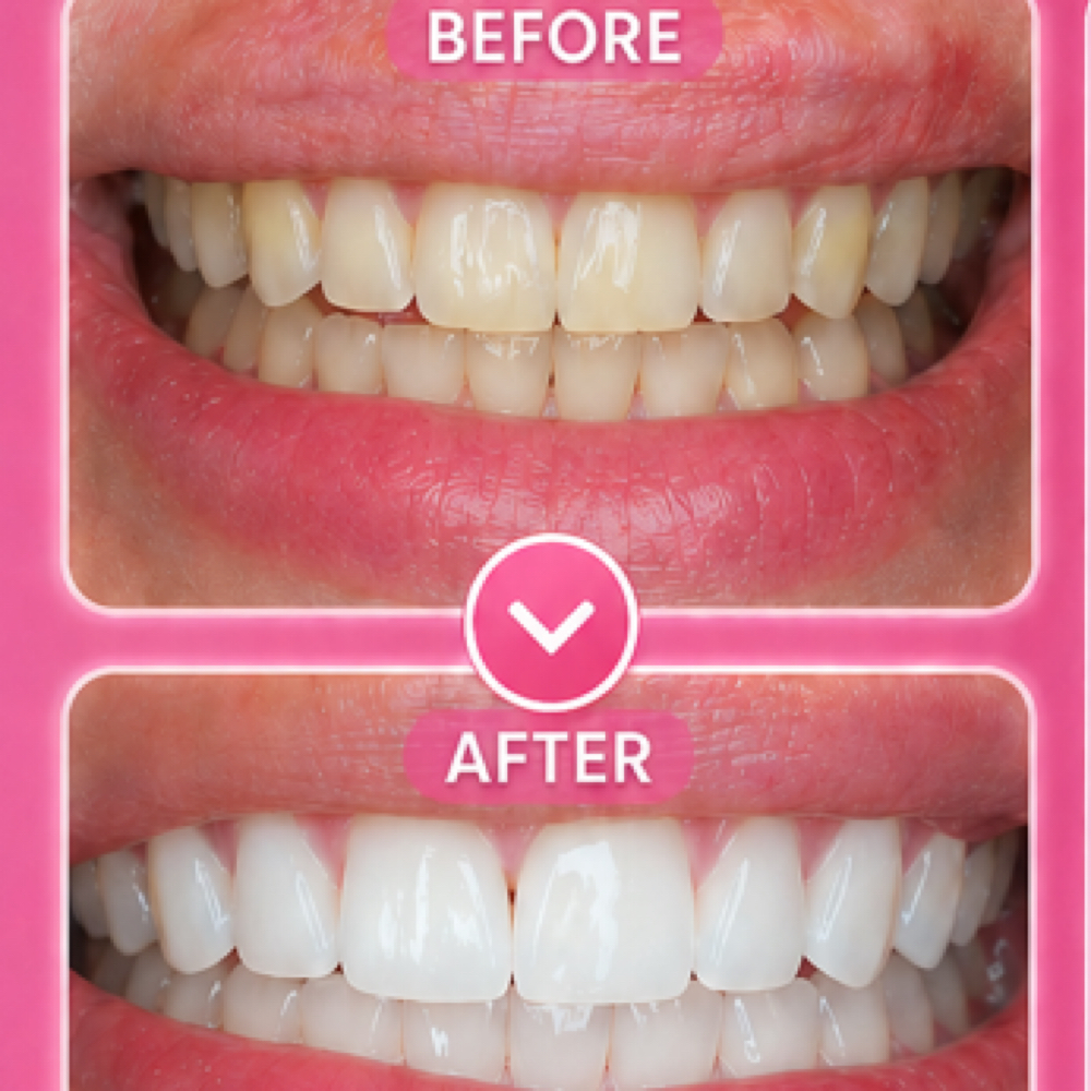 Teeth Whitening 🦷 at De Colores Beauty Bar in Chicago, IL