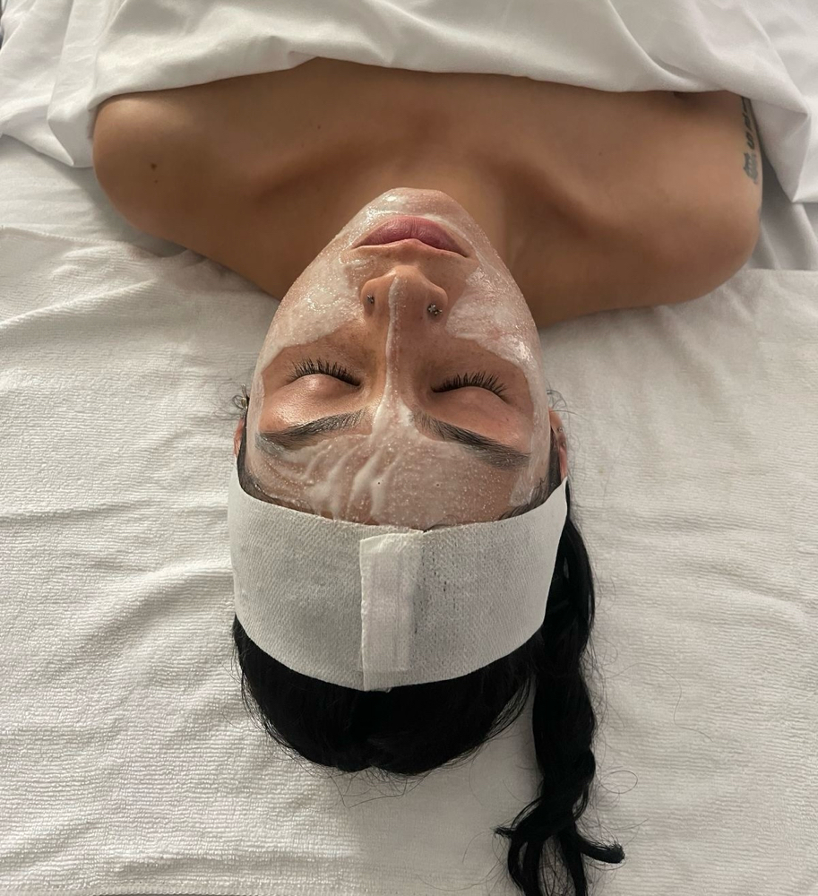 The Acne Facial
