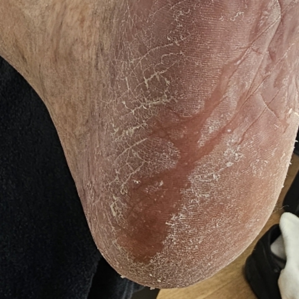Therapeutic Pedicure L2 at Mani D'Oro in Munster, IN