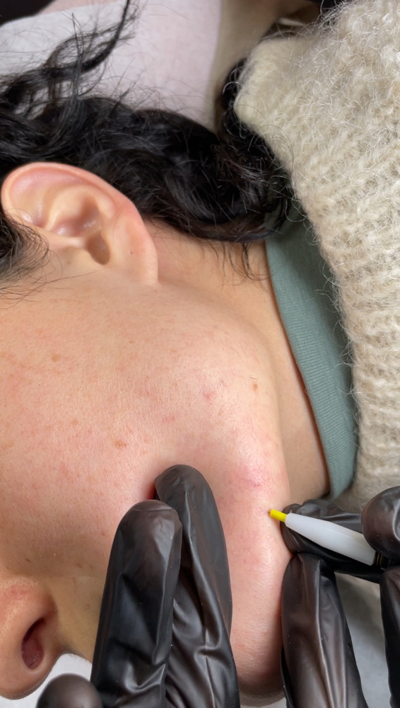 Electrolysis Consult