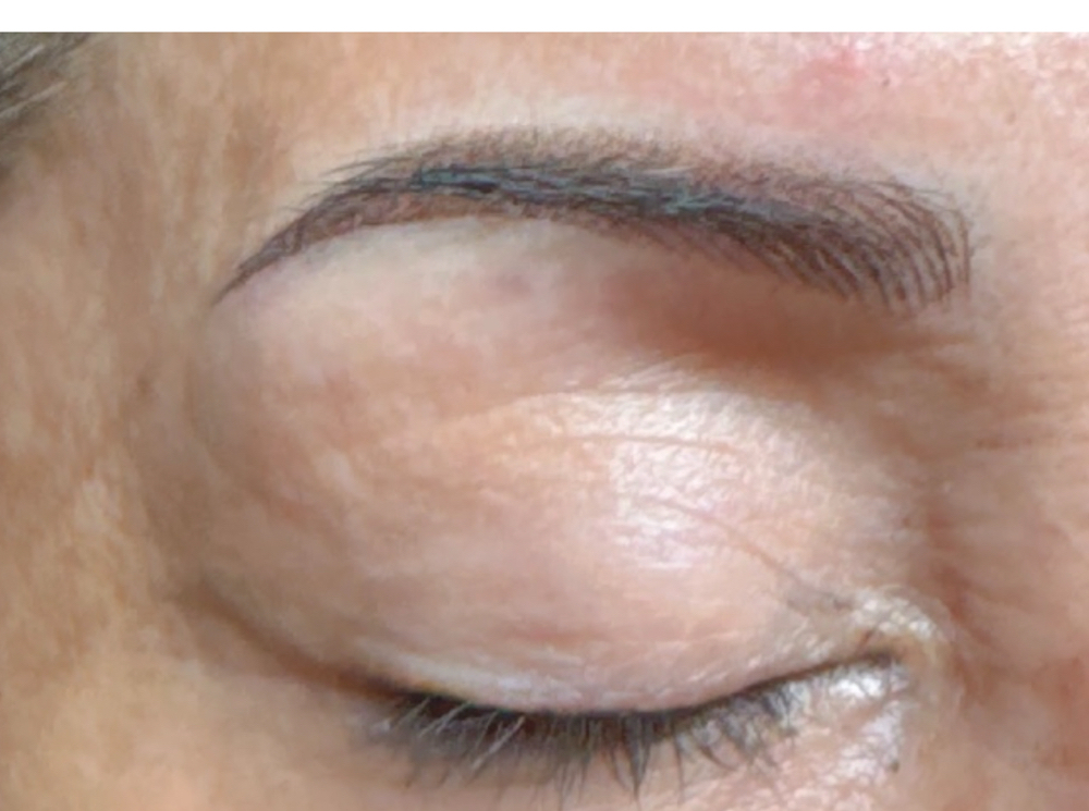 Brow Combo