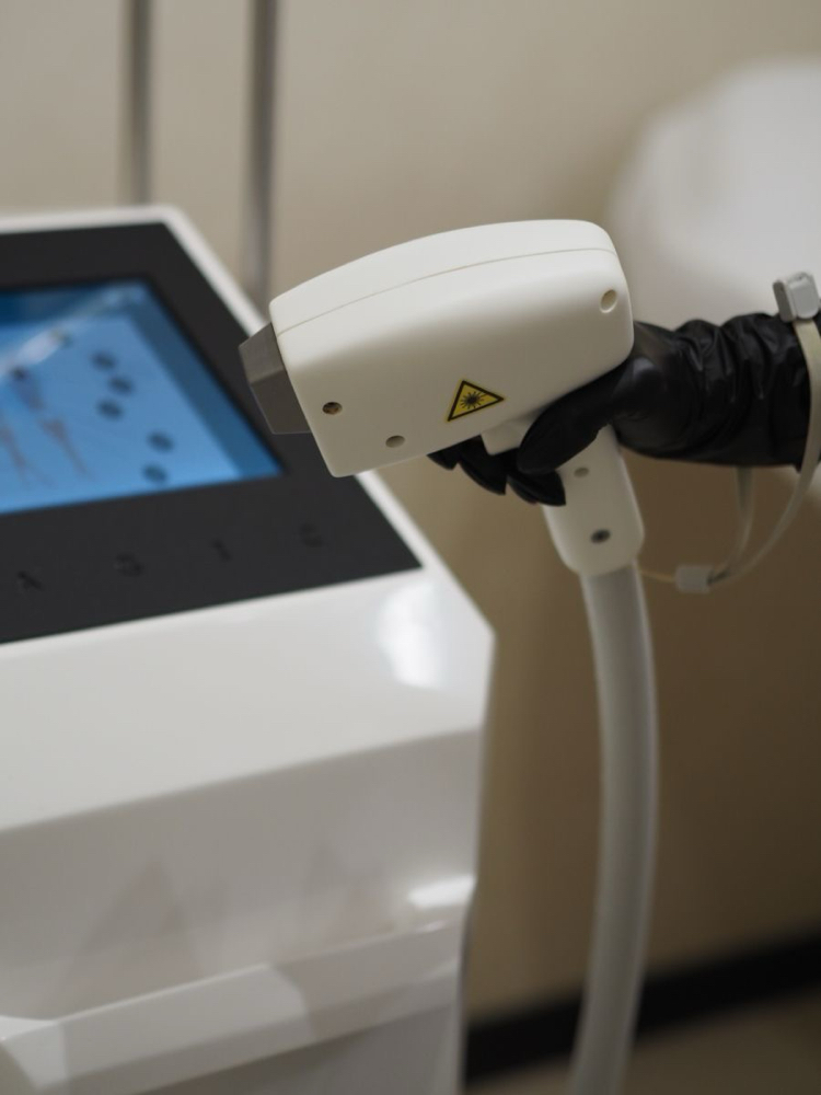 Men’s Beard & Neck Laser Treatment