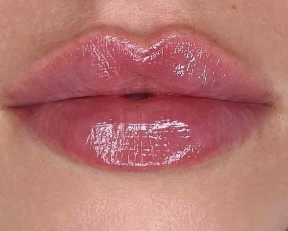 Labios Relleno Medio