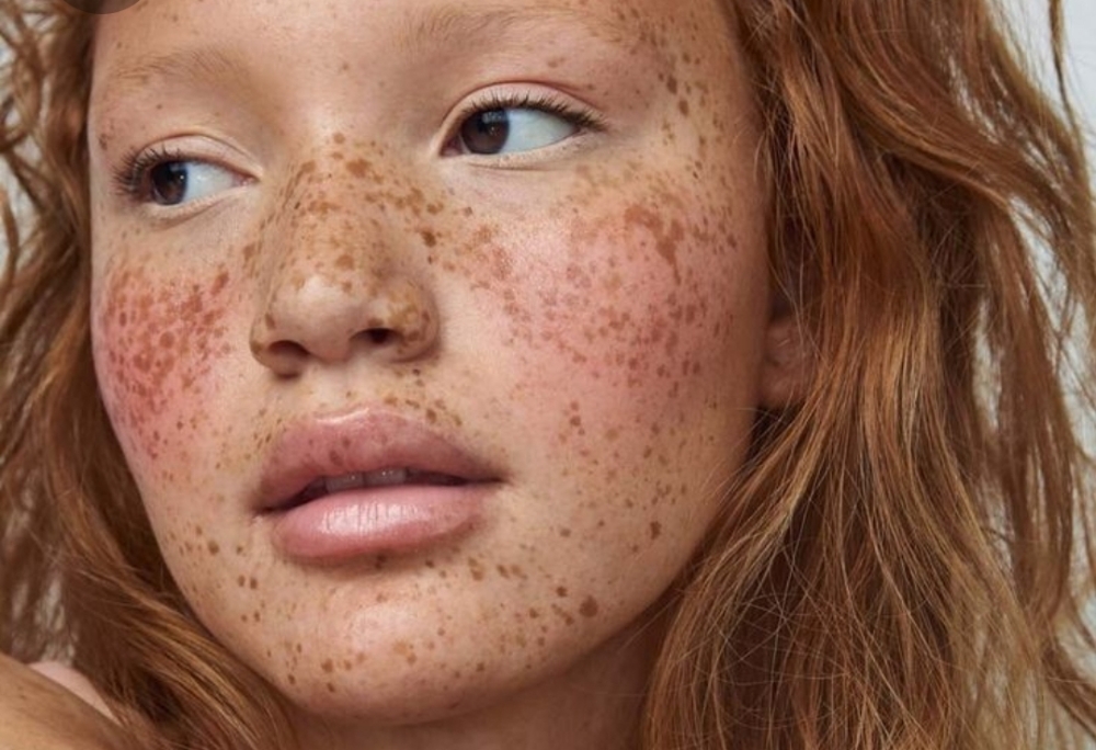 Permanent Freckles at Kiki Ink Cosmetic & Vegan Tattoos in Eugene, OR