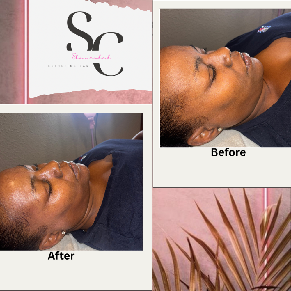 The System Reboot ( Rejuvenating)