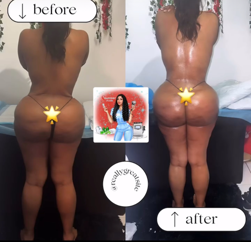 Lymphatic Sculpting (Post-Op Suppor at ShapedbyNicolabrowsandbody in Brooklyn, NY