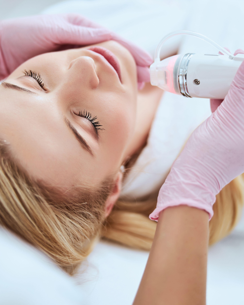 Microneedlong With Radio Frequency