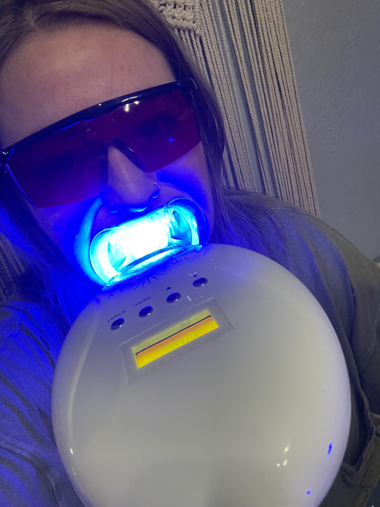 Teeth Whitening Single Session