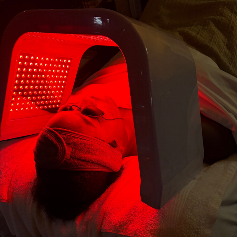 Teen Clarity Treatment at Skyn Unveiled in Dallas, TX