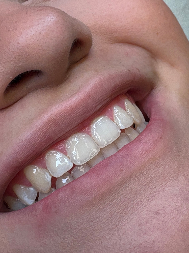 30 min Mini Glow Up at Aura Skin x Marissa in Alice, TX