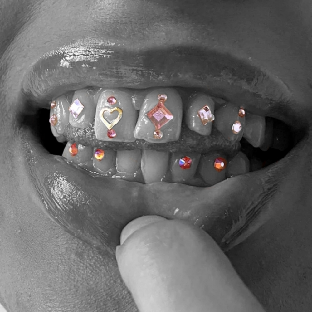 Custom Tooth Gem Set at The Neon Door in Tucson, AZ