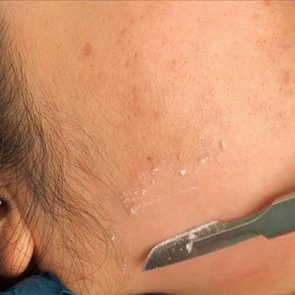 Dermaplane Facial at Beauty Spa 11 in Mission, KS