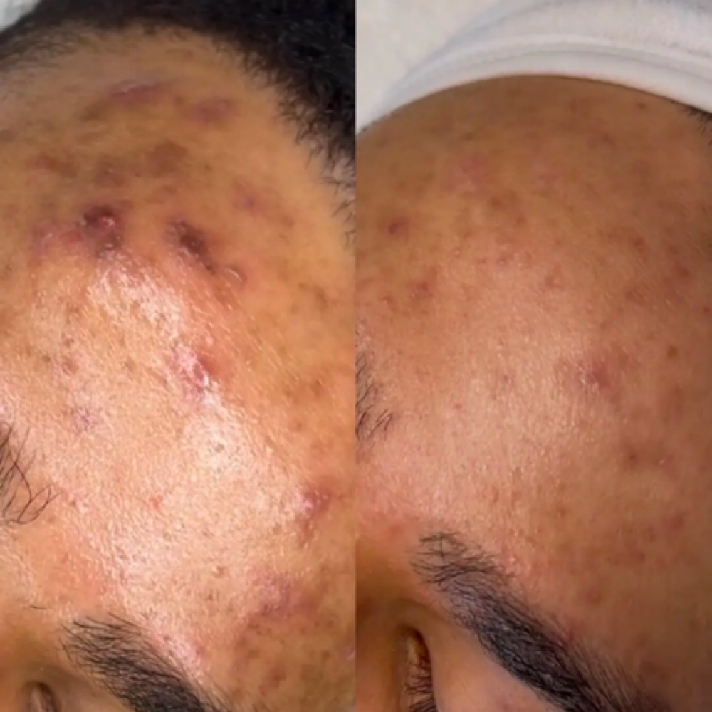 Brightening Facial at Perla’s Nails in Orlando, FL