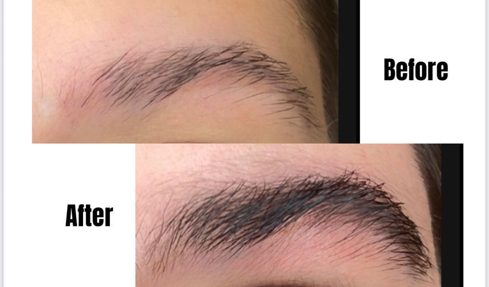 Brows follicle stimulation
