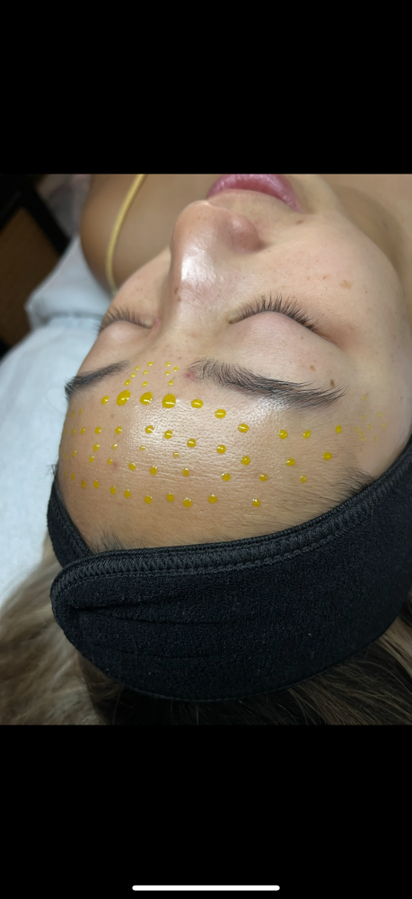Glass Skin Spa Peel