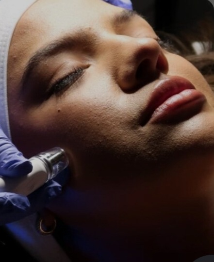 MICRODERMABRASION